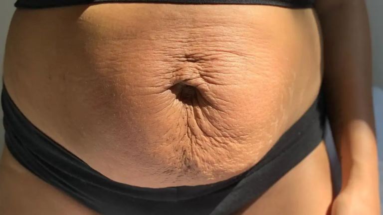 Postpartum Body Changes, Demystified