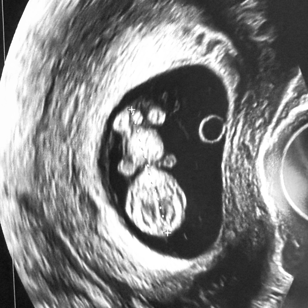 Photo shared by Shiva for their Babylist baby registry.