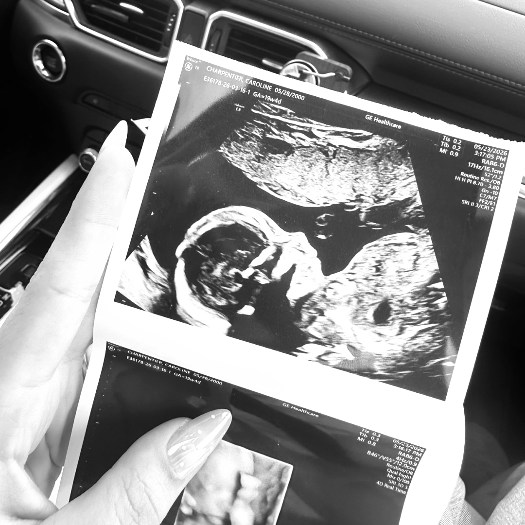 Photo shared by Caroline for their Babylist baby registry.