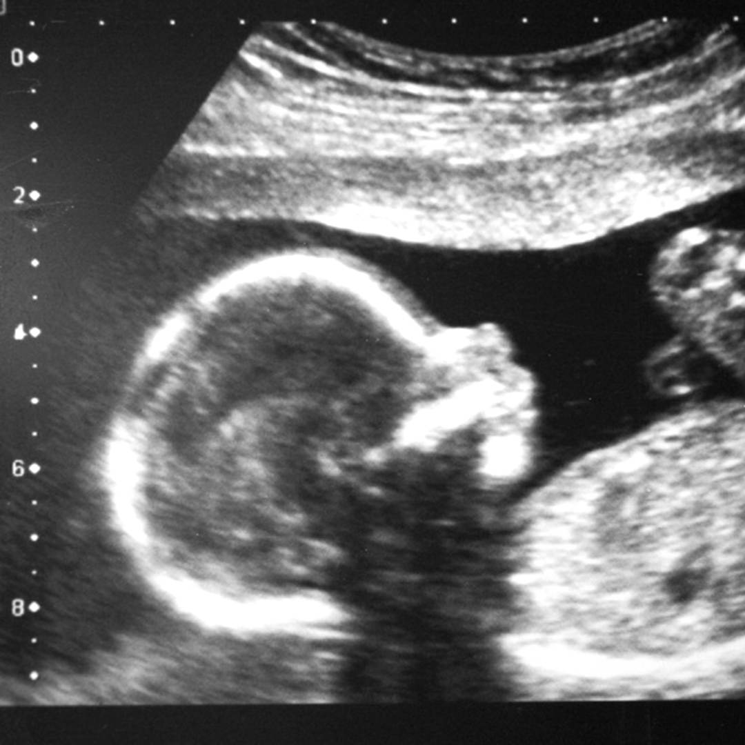 Photo shared by Juliana for their Babylist baby registry.