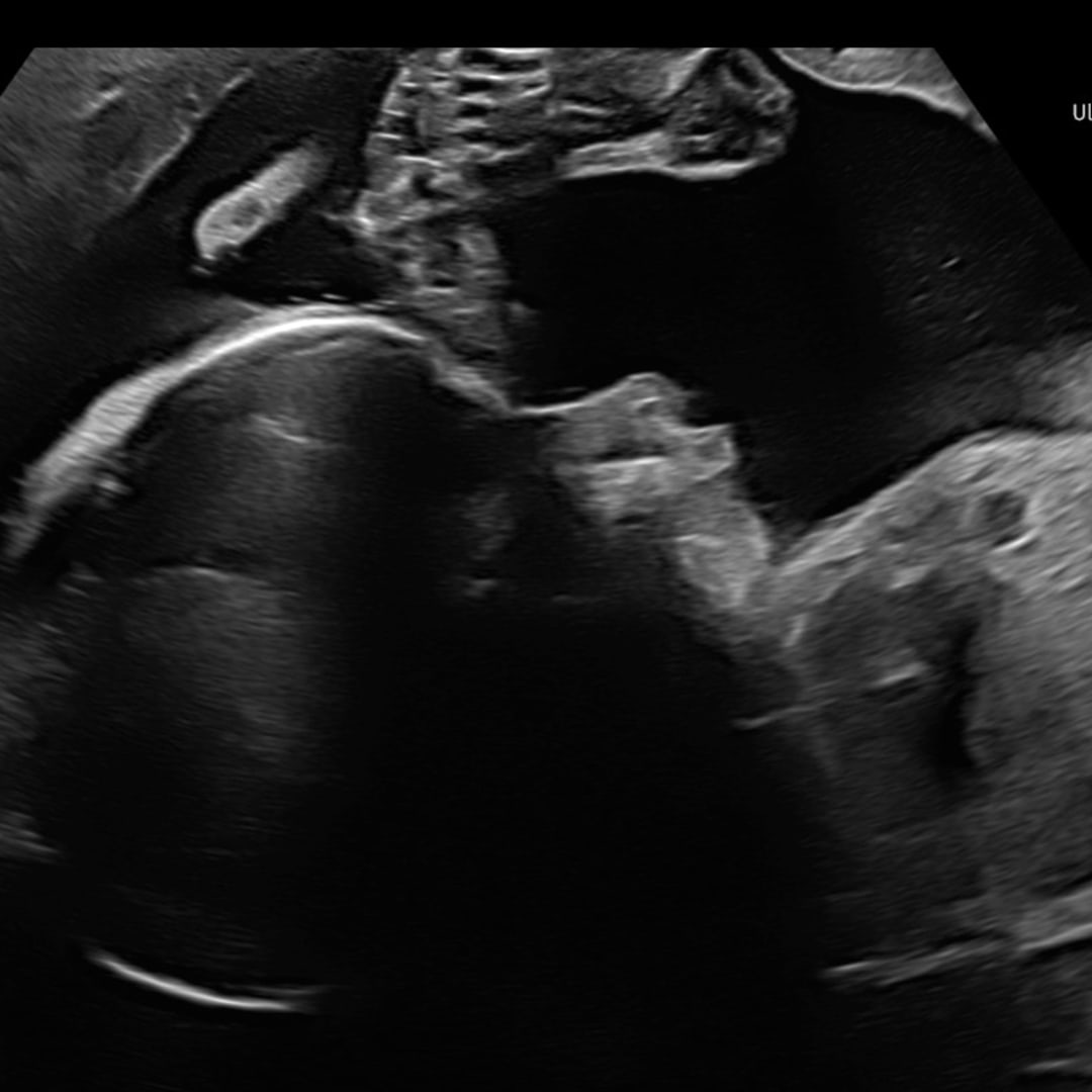 Photo shared by Madison for their Babylist baby registry.