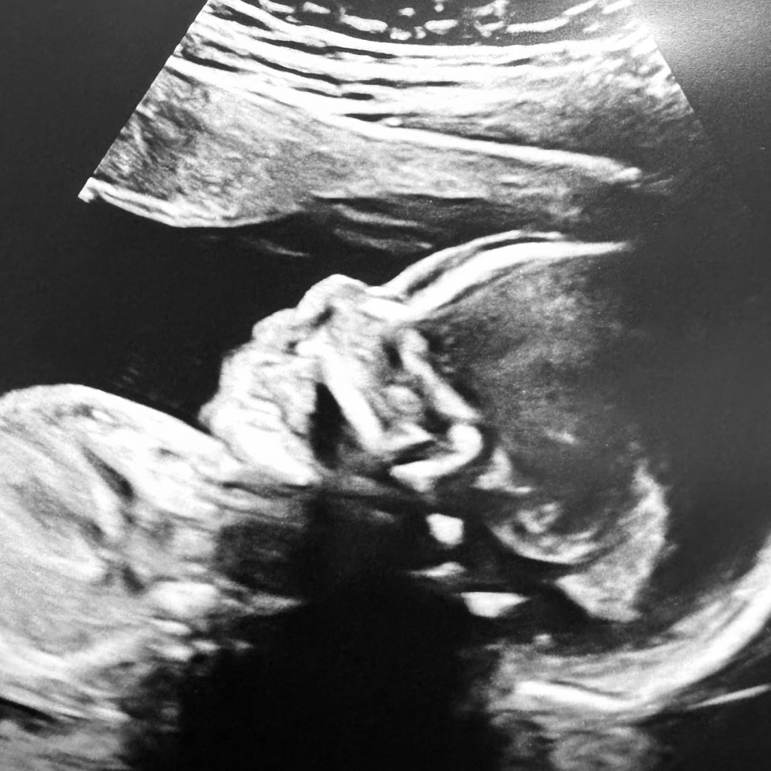Photo shared by Ginneza for their Babylist baby registry.