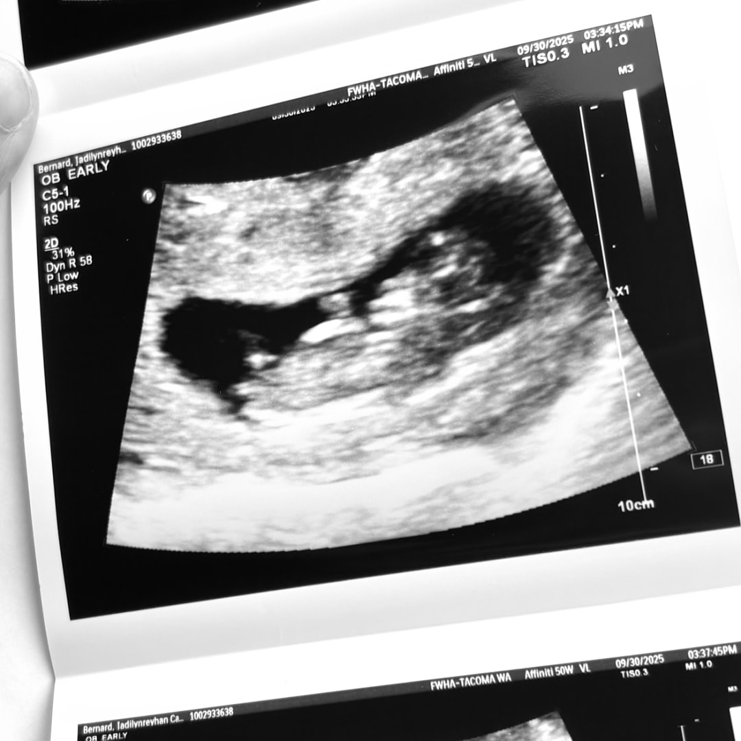 Photo shared by Jadilyn for their Babylist baby registry.