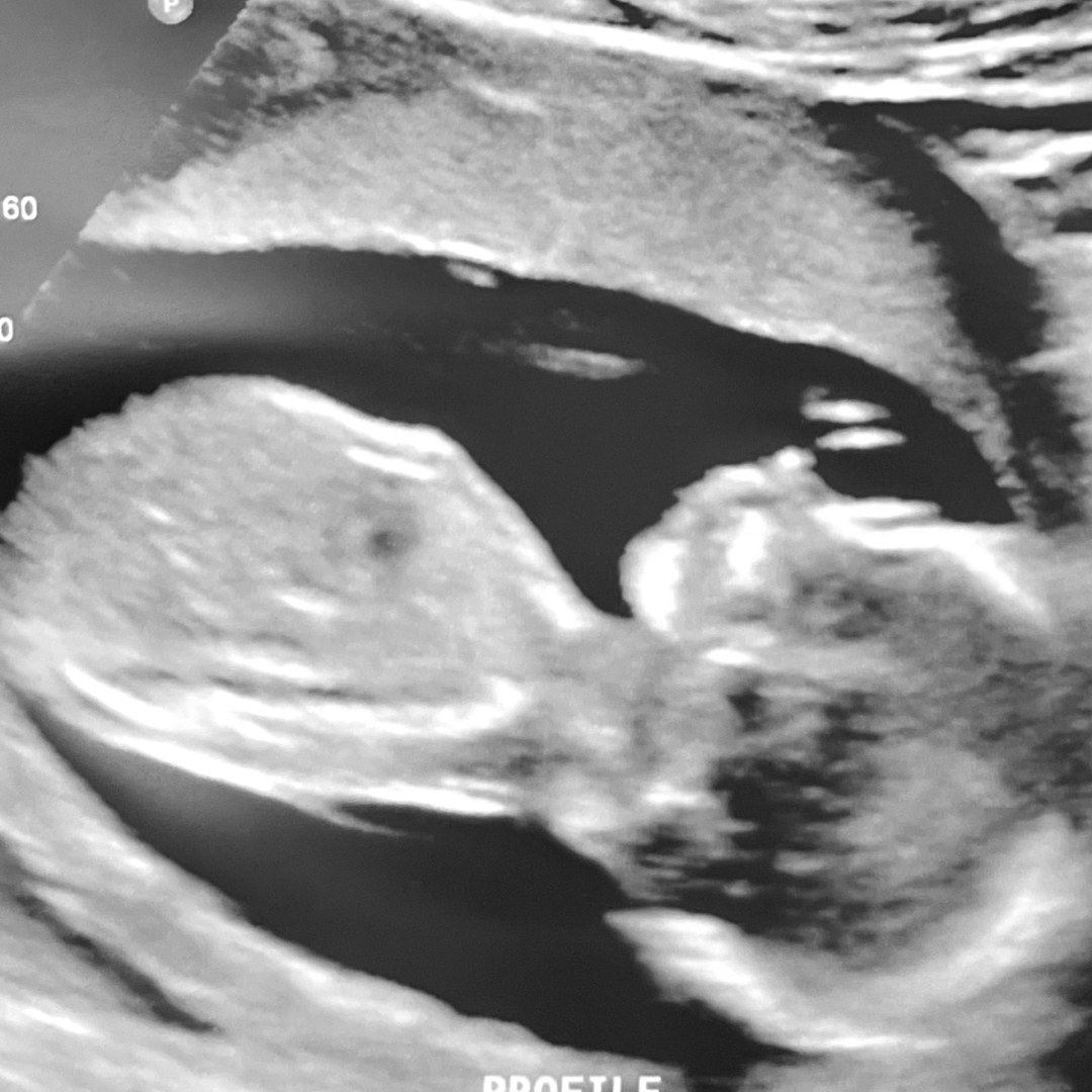 Photo shared by Alicia for their Babylist baby registry.