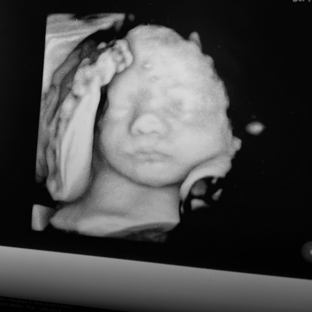 Photo shared by Skylar for their Babylist baby registry.