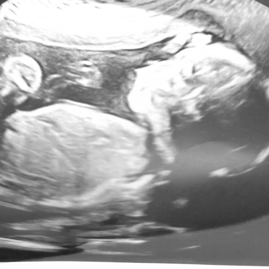 Photo shared by Christian for their Babylist baby registry.