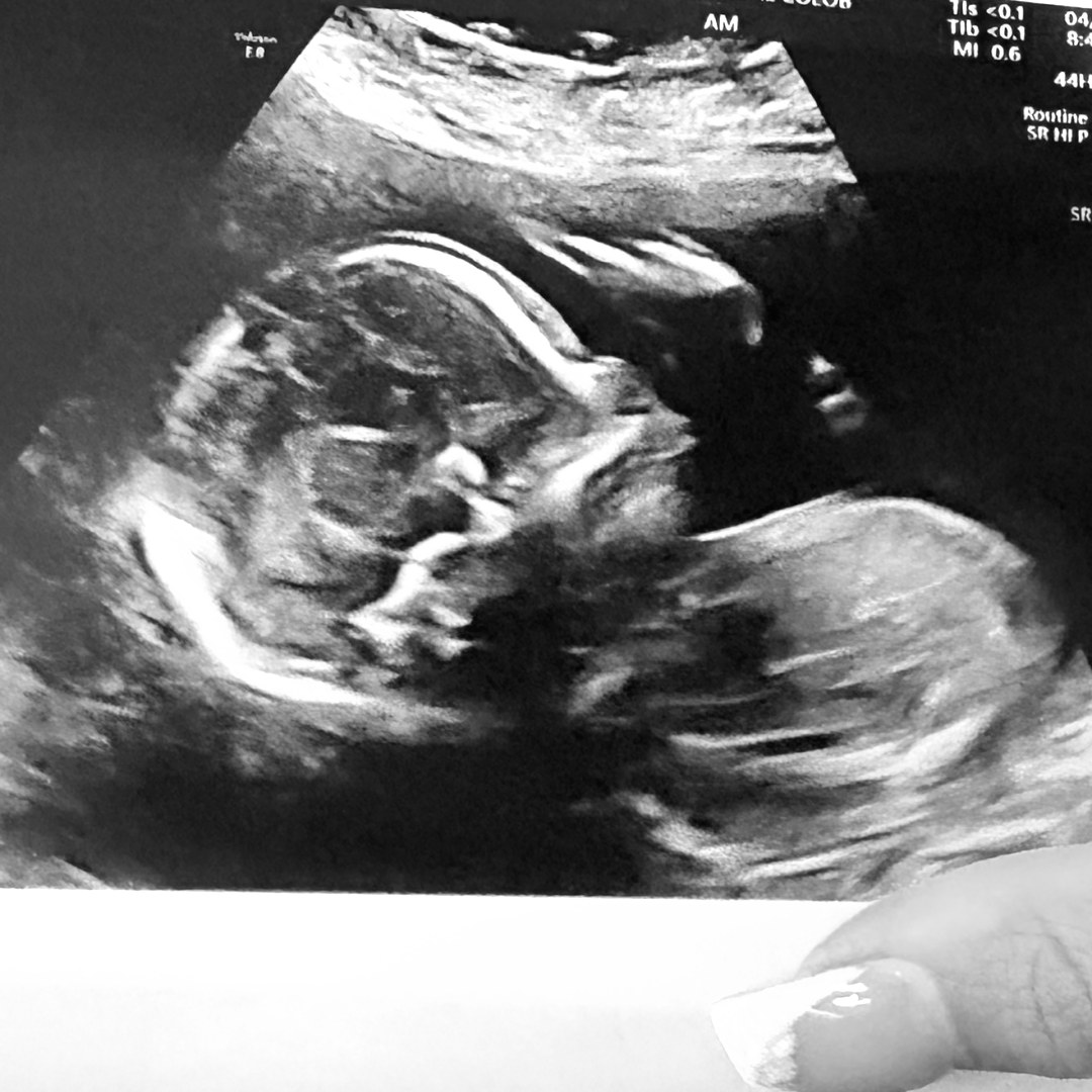 Photo shared by Xatziri for their Babylist baby registry.