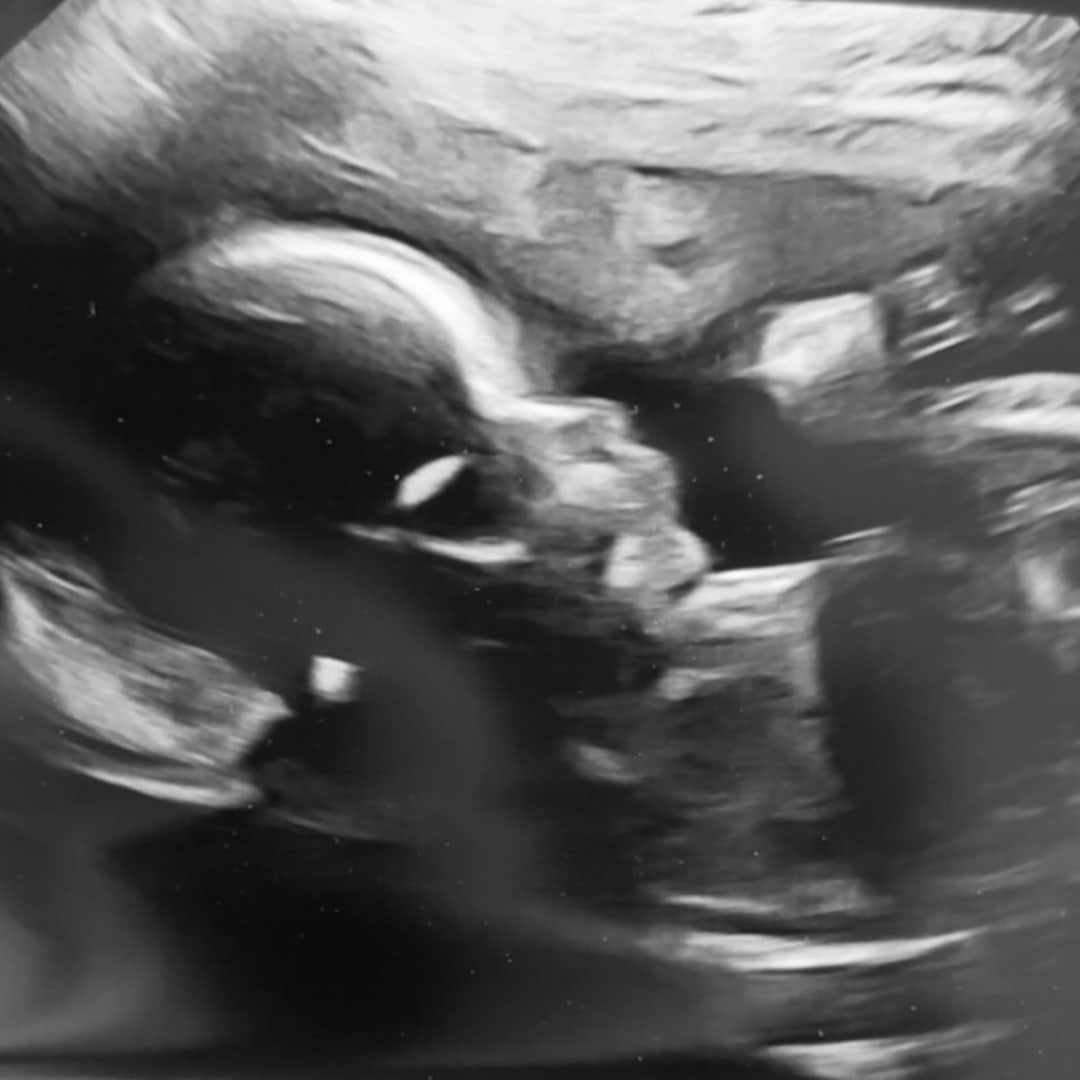 Photo shared by Courtney for their Babylist baby registry.