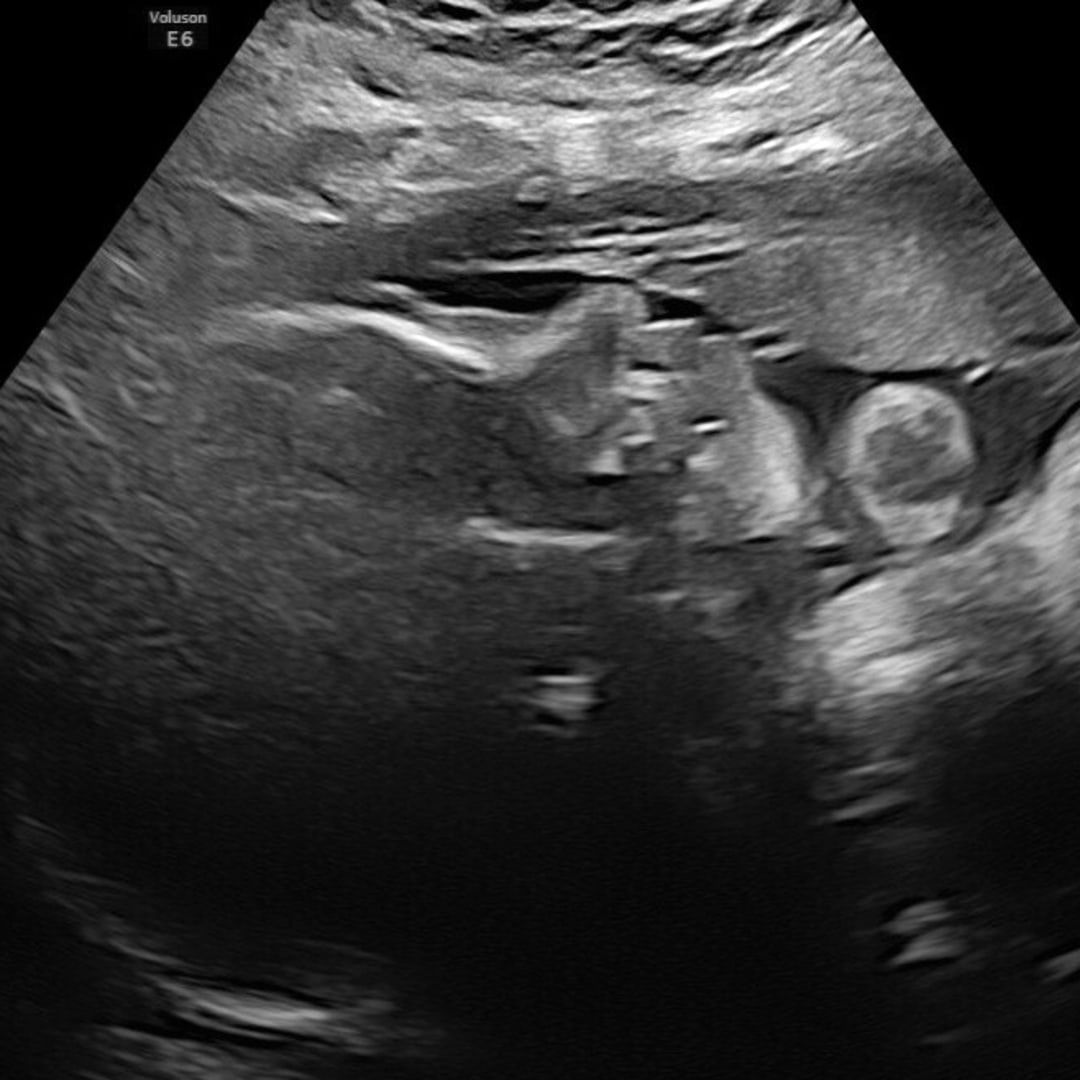 Photo shared by Payton for their Babylist baby registry.