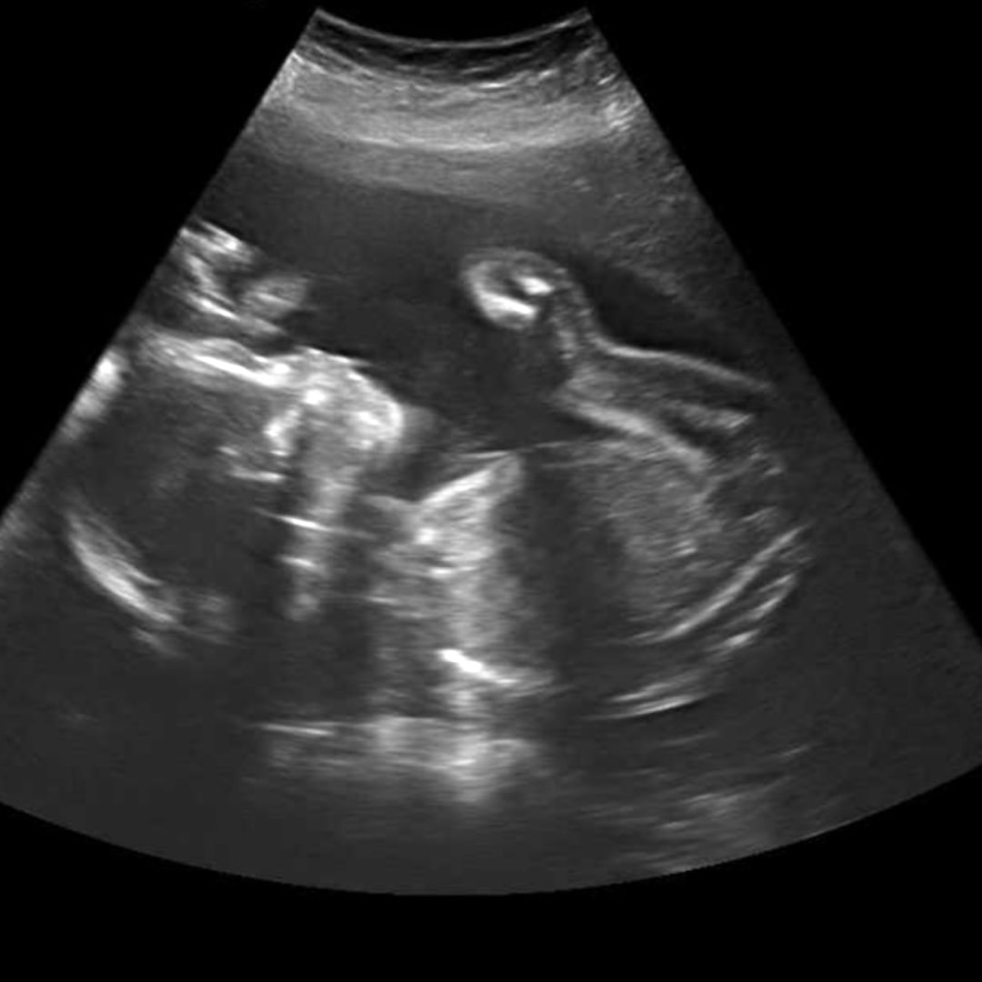 Photo shared by Cori for their Babylist baby registry.
