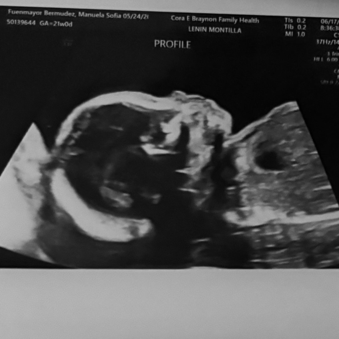 Photo shared by Manuela for their Babylist baby registry.