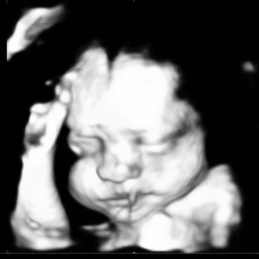 Photo shared by Jaclyn for their Babylist baby registry.