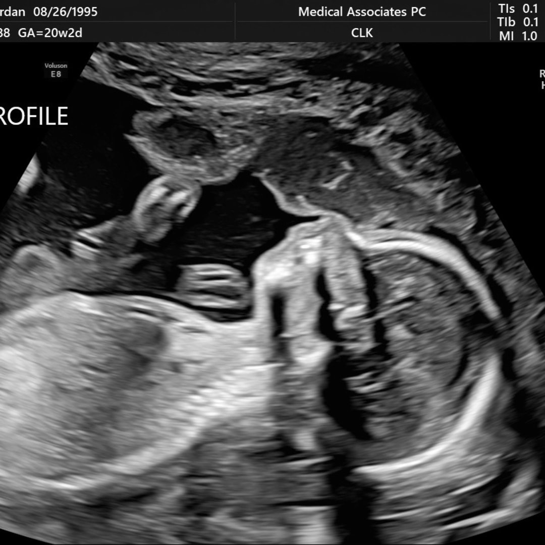 Photo shared by Jordan for their Babylist baby registry.