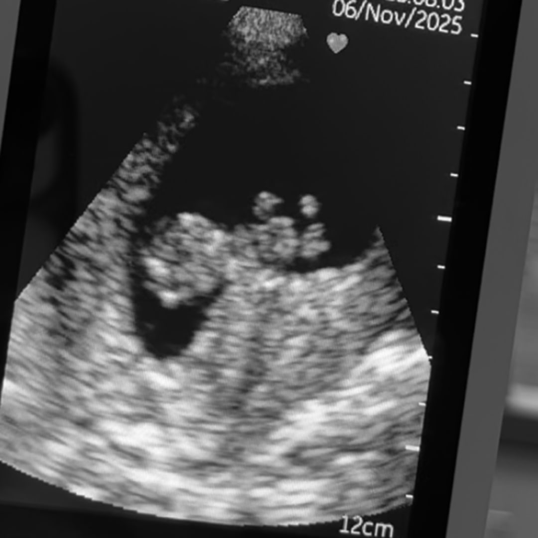 Photo shared by Leann for their Babylist baby registry.