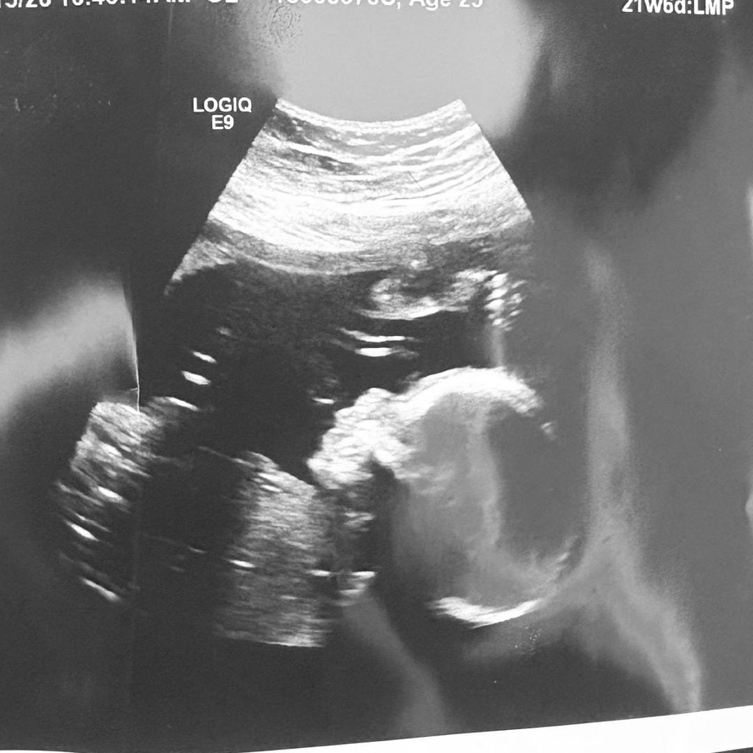 Photo shared by Nicole for their Babylist baby registry.