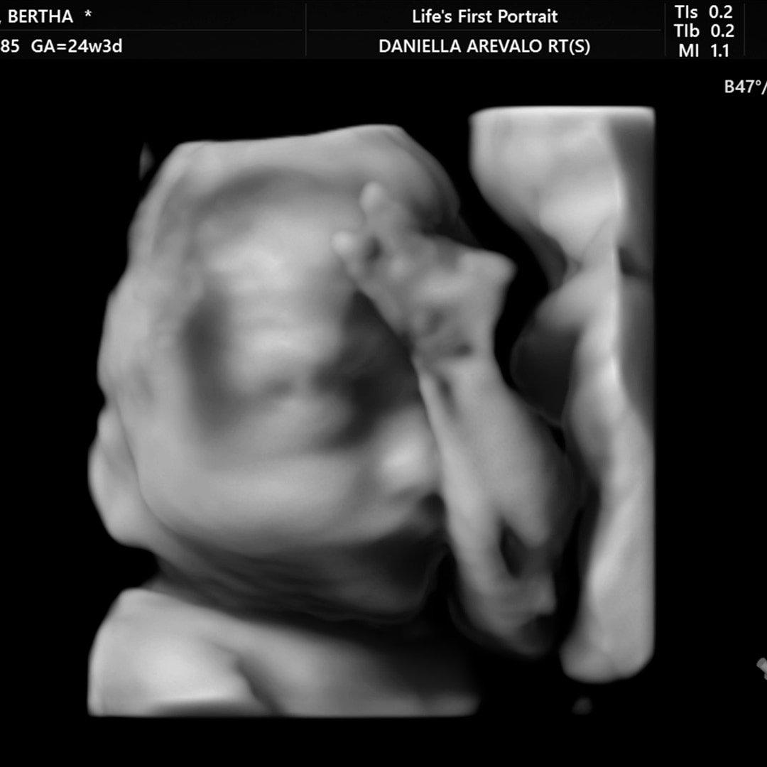 Photo shared by Bertha for their Babylist baby registry.