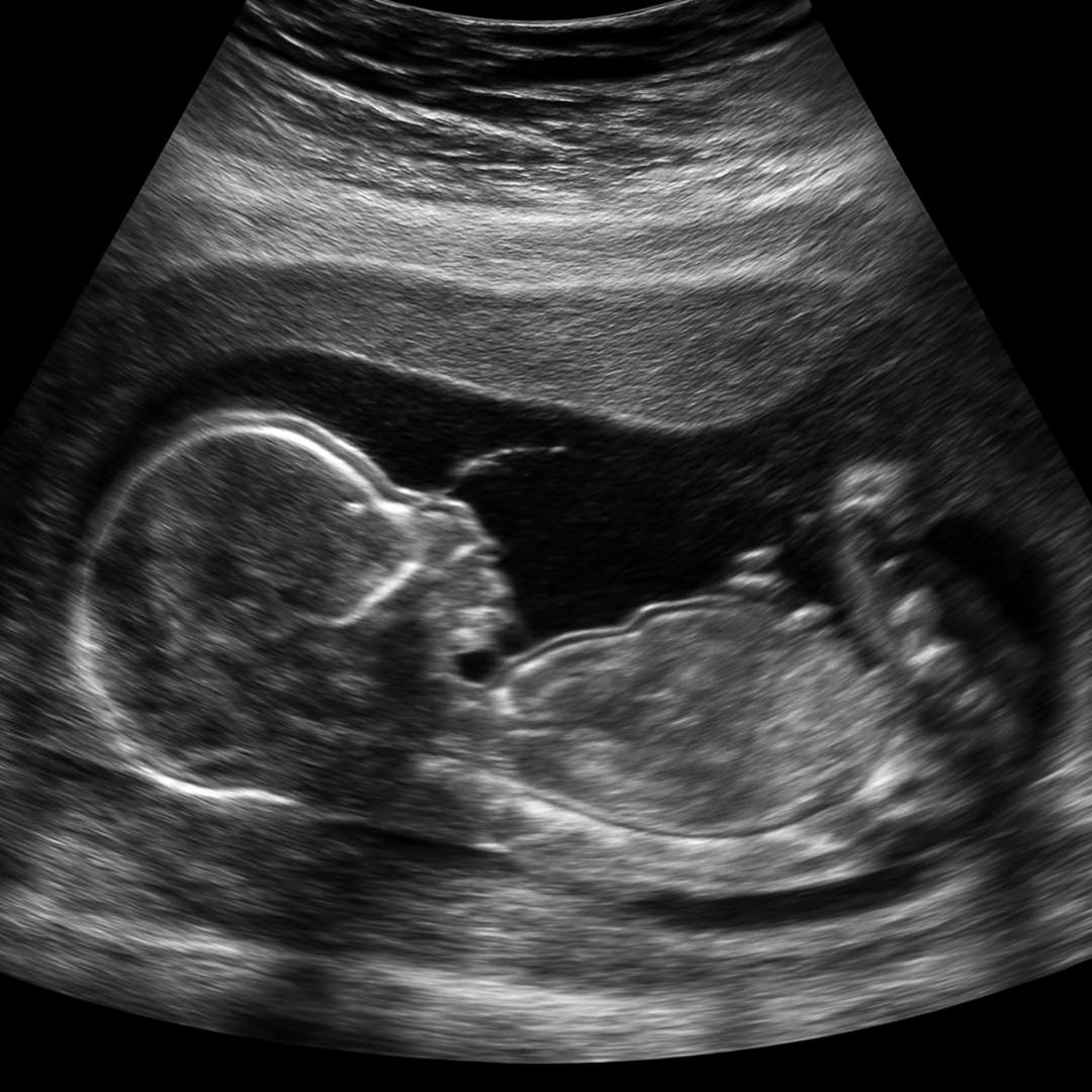 Photo shared by Ryan for their Babylist baby registry.