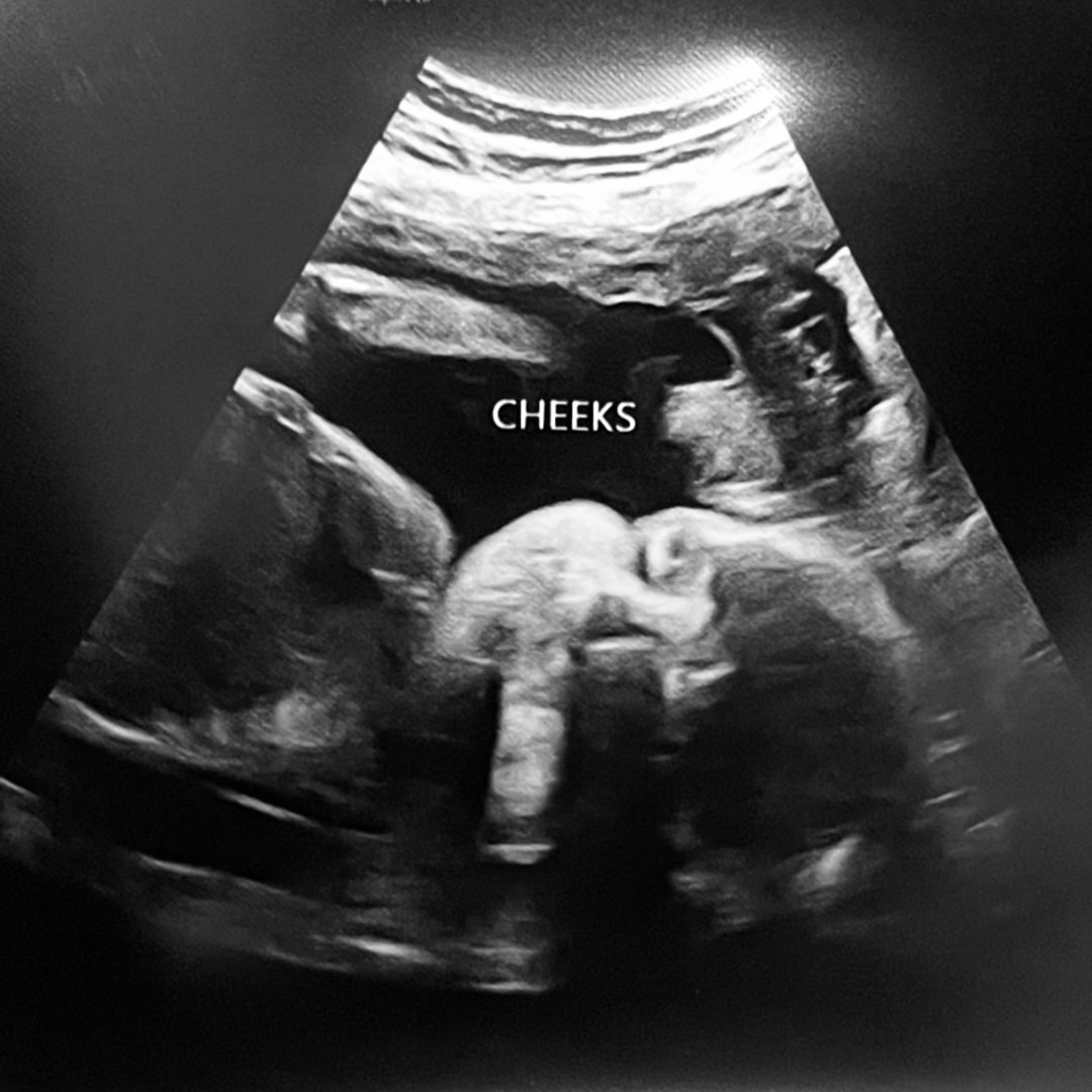 Photo shared by Cailynn for their Babylist baby registry.