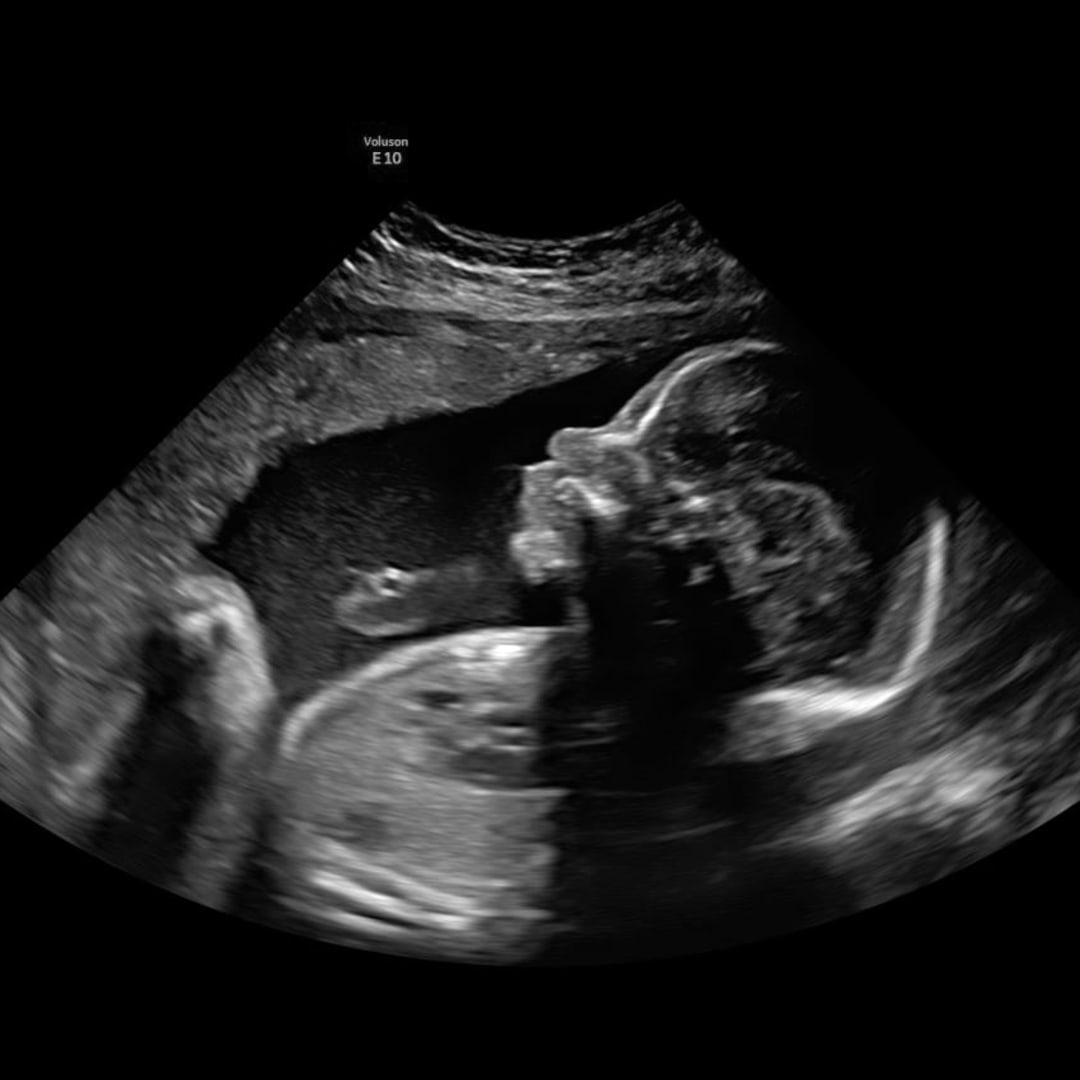 Photo shared by Jasmin for their Babylist baby registry.