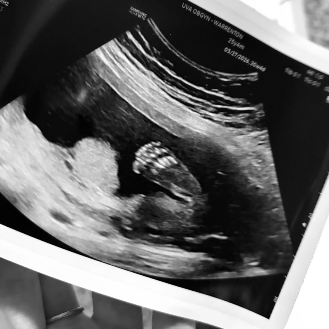 Photo shared by Tacey for their Babylist baby registry.