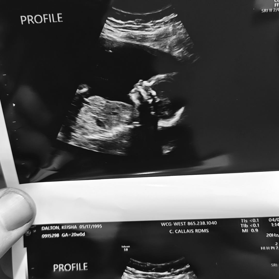 Photo shared by Keisha for their Babylist baby registry.