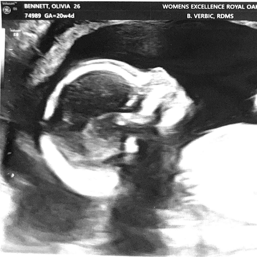 Photo shared by Olivia for their Babylist baby registry.