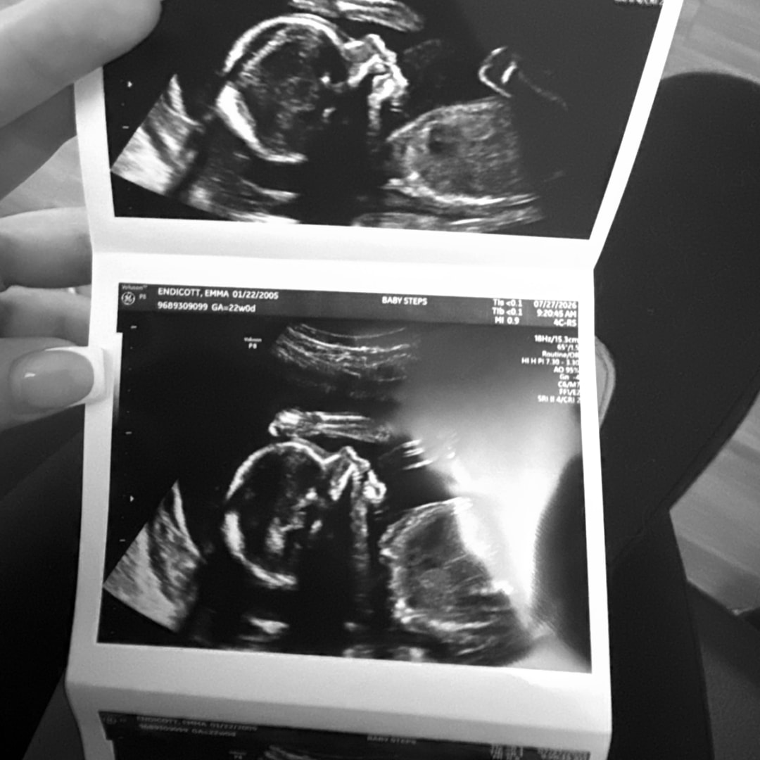 Photo shared by Emma for their Babylist baby registry.