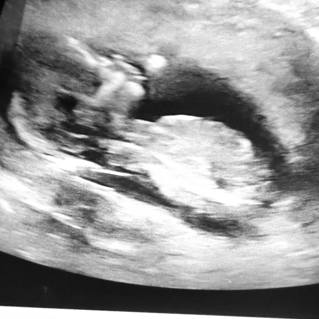 Photo shared by Lizette for their Babylist baby registry.