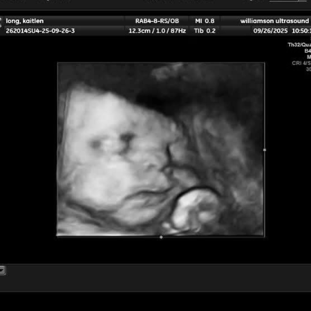 Photo shared by Kaitlen for their Babylist baby registry.