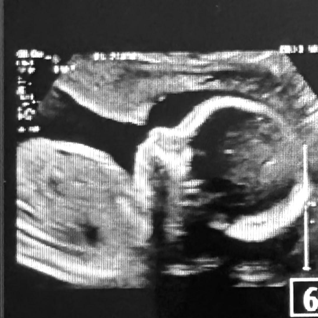 Photo shared by Jailene for their Babylist baby registry.