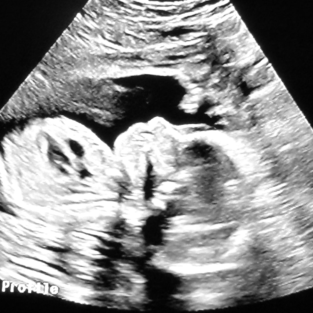 Photo shared by Daniti for their Babylist baby registry.