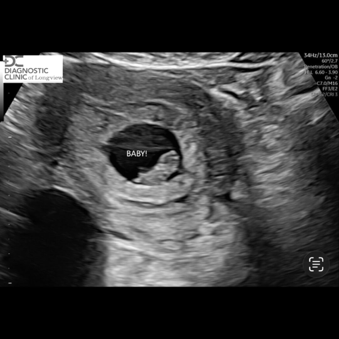 Photo shared by Sarah for their Babylist baby registry.