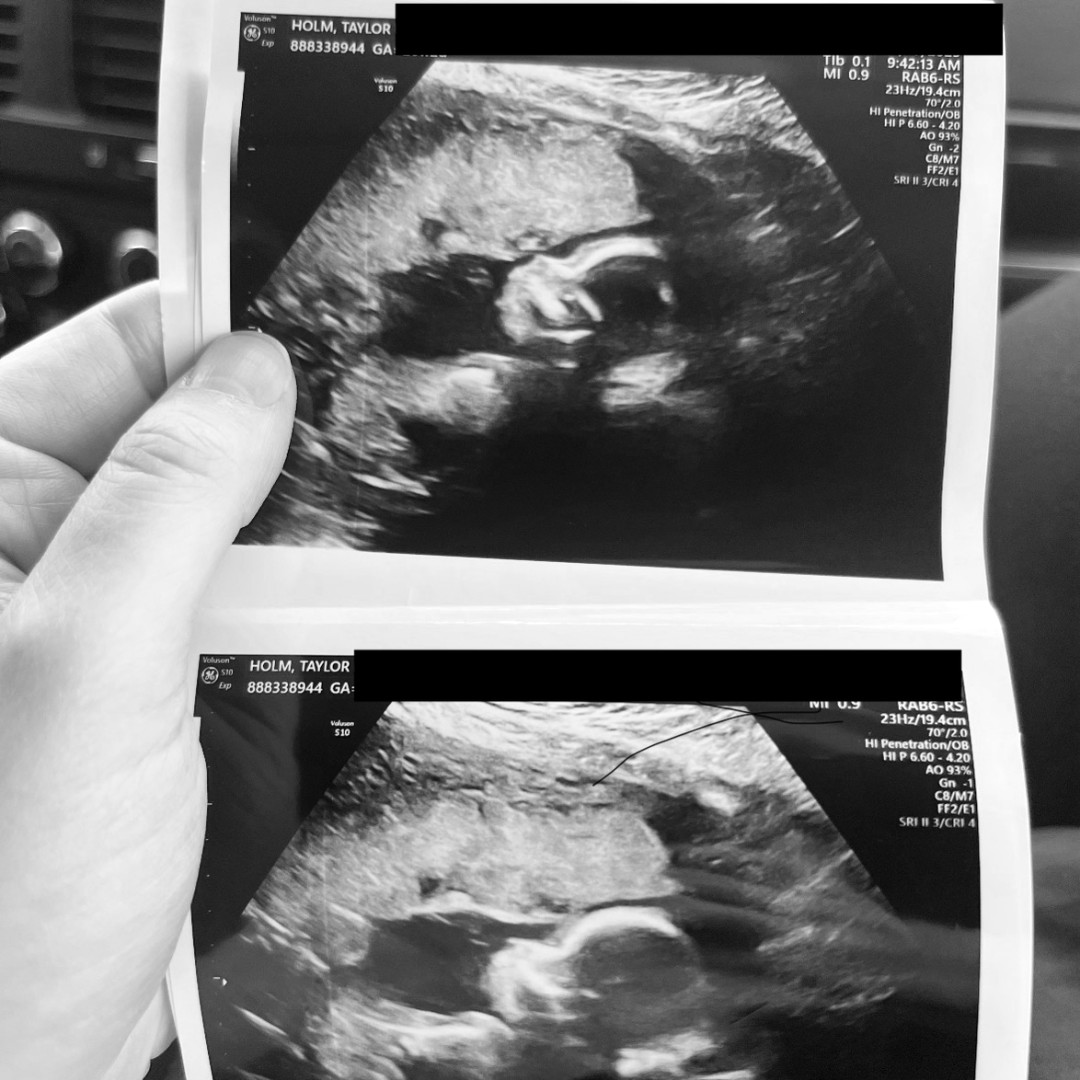 Photo shared by Cory for their Babylist baby registry.