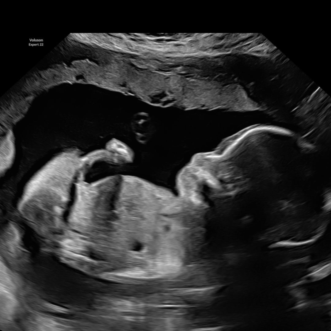 Photo shared by Tiffany for their Babylist baby registry.