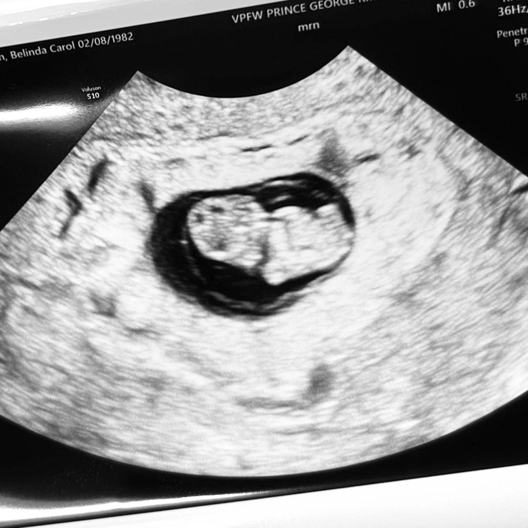 Photo shared by Belinda for their Babylist baby registry.