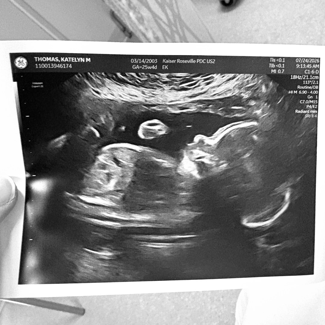 Photo shared by Katie for their Babylist baby registry.