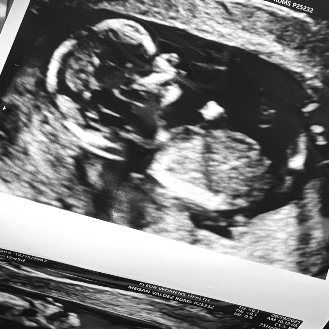 Photo shared by Ariana for their Babylist baby registry.