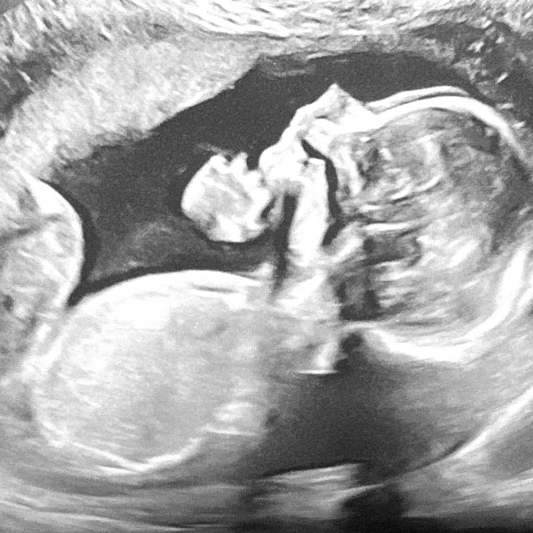 Photo shared by Hayley for their Babylist baby registry.