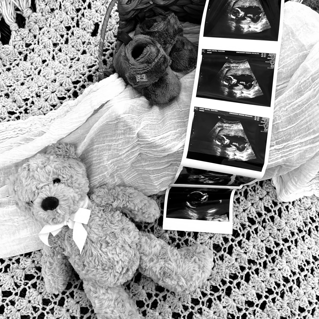 Photo shared by Rachell for their Babylist baby registry.