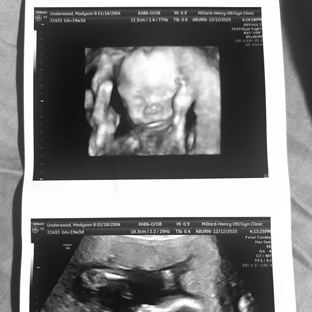 Photo shared by Maddy for their Babylist baby registry.