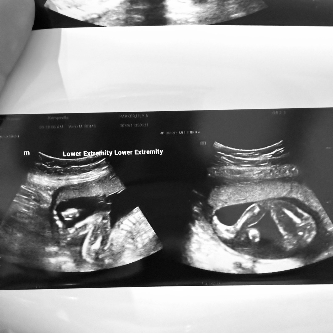 Photo shared by Lily for their Babylist baby registry.