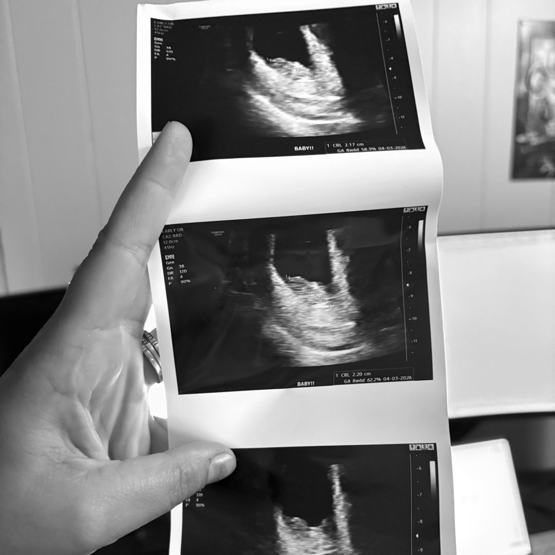 Photo shared by Kailee for their Babylist baby registry.