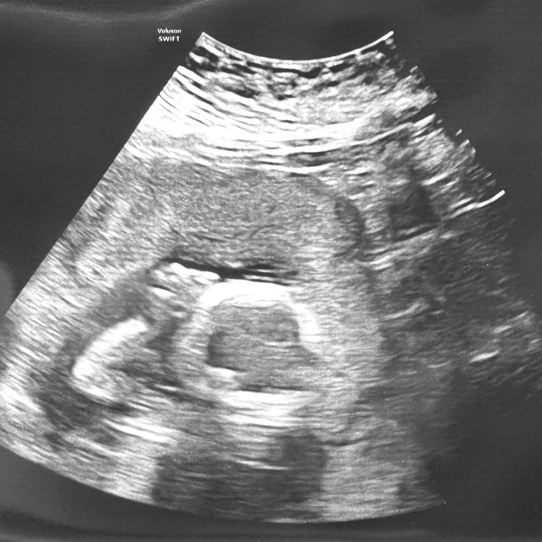 Photo shared by Alex for their Babylist baby registry.