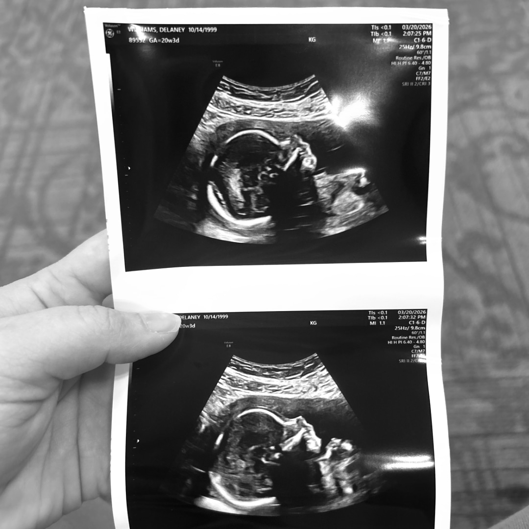 Photo shared by Delaney for their Babylist baby registry.