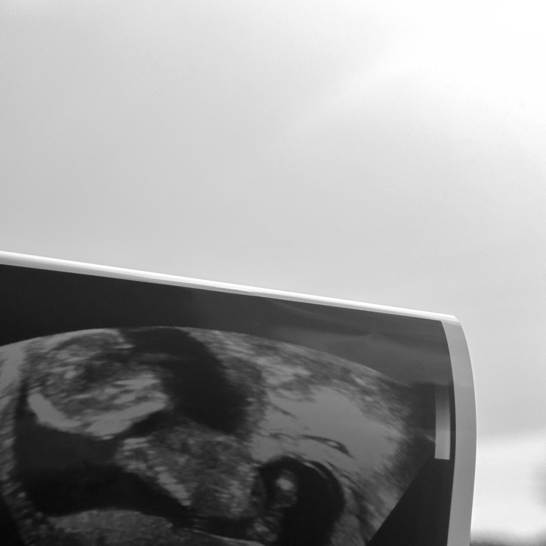 Photo shared by Jade for their Babylist baby registry.