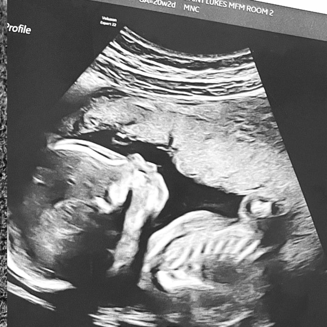 Photo shared by Khia for their Babylist baby registry.