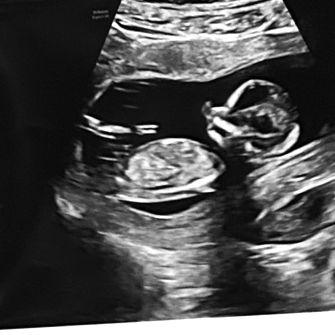 Photo shared by Avery for their Babylist baby registry.