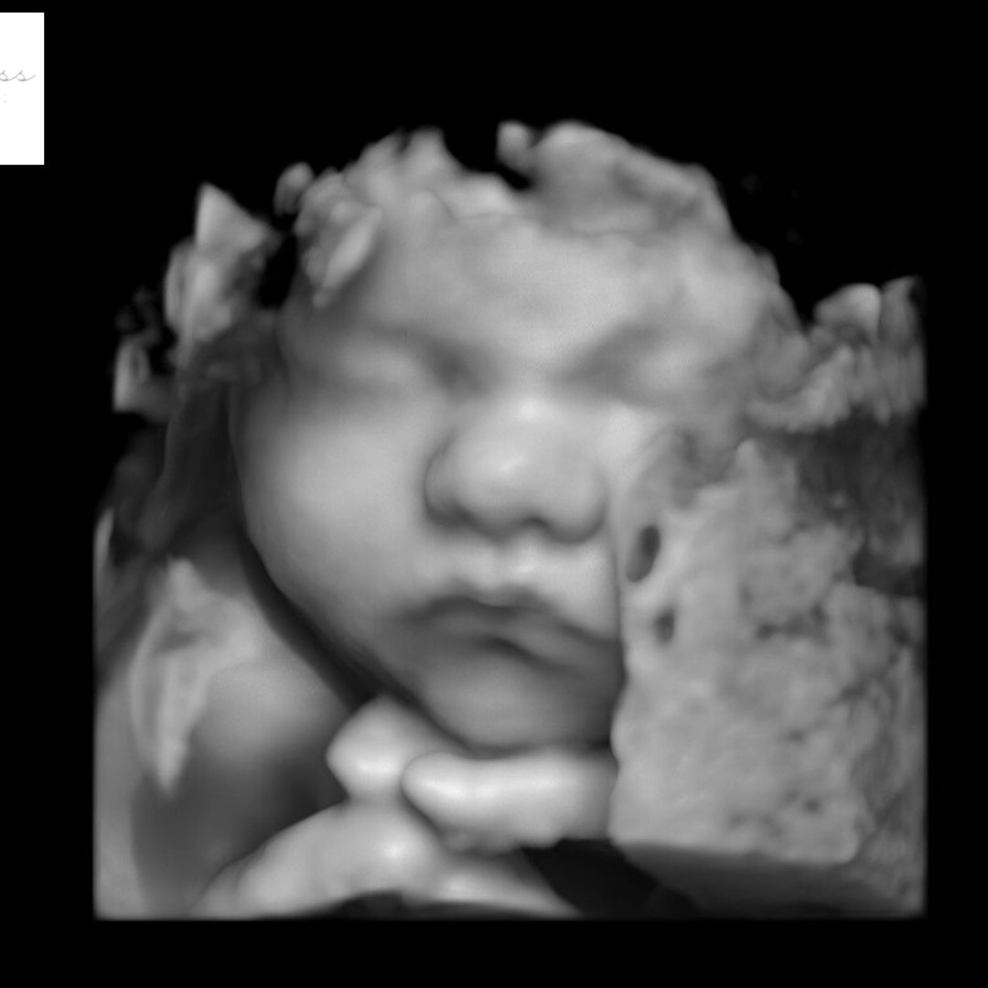 Photo shared by Kelsey for their Babylist baby registry.