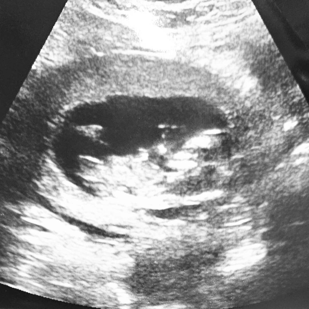 Photo shared by Natasha for their Babylist baby registry.