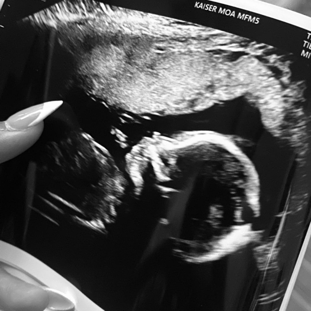 Photo shared by Elizabella for their Babylist baby registry.